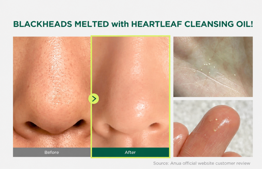 Anua_Heartleaf_Pore_Control_Cleansing_Oil_20ml