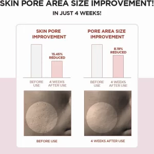 SKIN1004 Madagascar Centella Poremizing Fresh Ampoule Serum 50ml