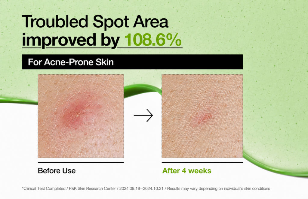 Anua Azelaic Acid 10% Hyaluron Redness Soothing Serum (30ml)