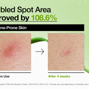Anua Azelaic Acid 10% Hyaluron Redness Soothing Serum (30ml)