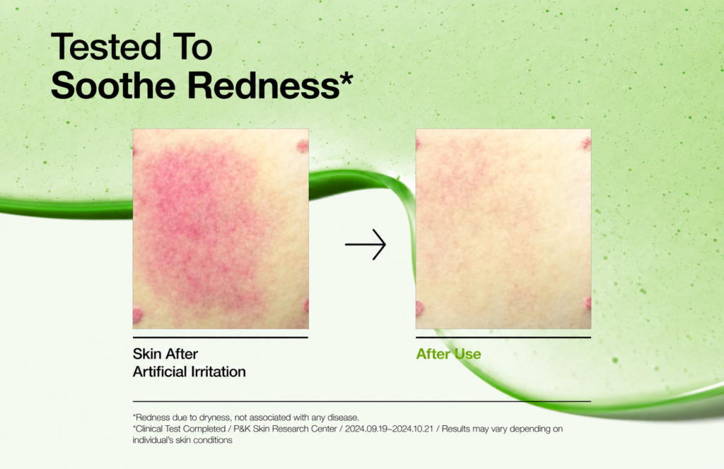 Anua Azelaic Acid 10% Hyaluron Redness Soothing Serum (30ml)