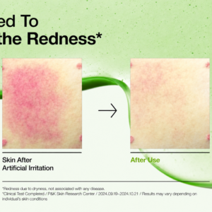 Anua Azelaic Acid 10% Hyaluron Redness Soothing Serum (30ml)