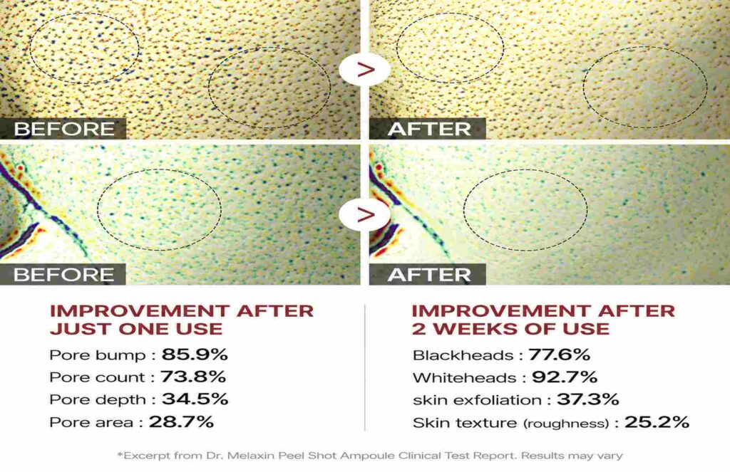 dr_melaxin_clinical_results_seamless_1845x1194_under100kb.jpg